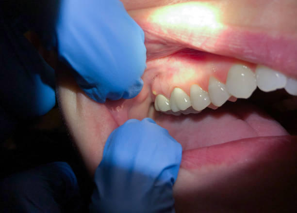 Best Emergency Broken Tooth Repair in Emsworth, PA